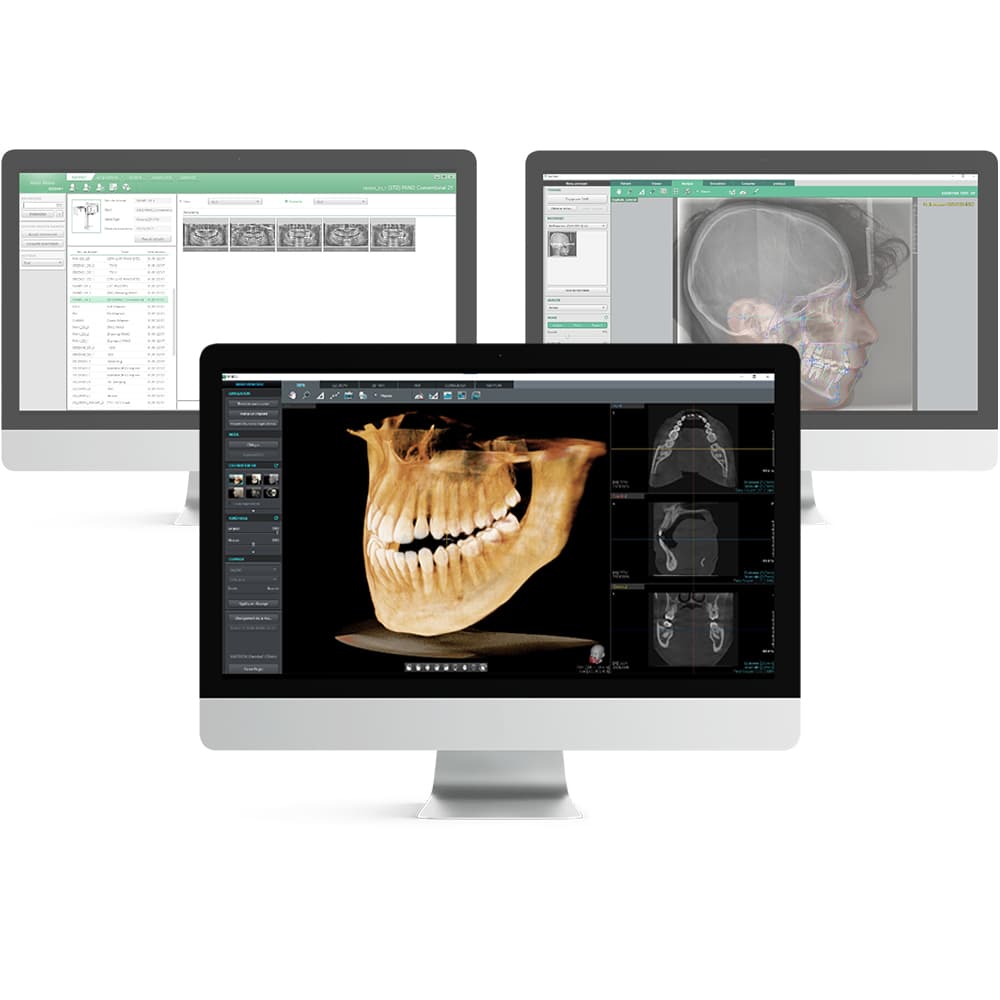 Ez3D-i VATECH — Logiciel d'imagerie 3D dentaire