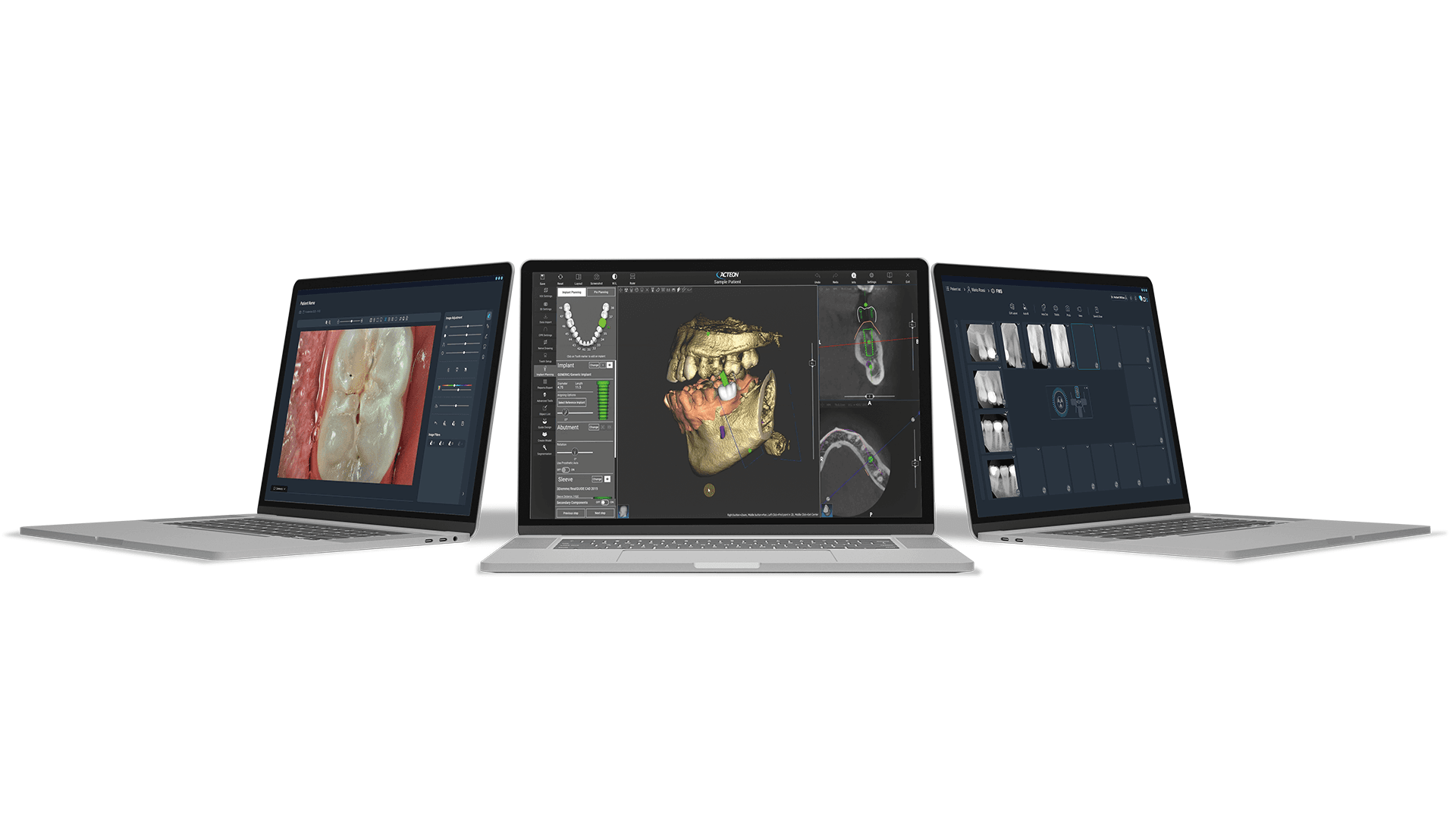 Logiciel d'imagerie AIS | ACTEON® Imaging Suite