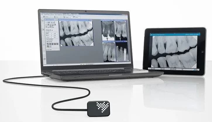 VistaRay 7 Dürr Dental — Capteur intra-oral CMOS 26 lp/mm